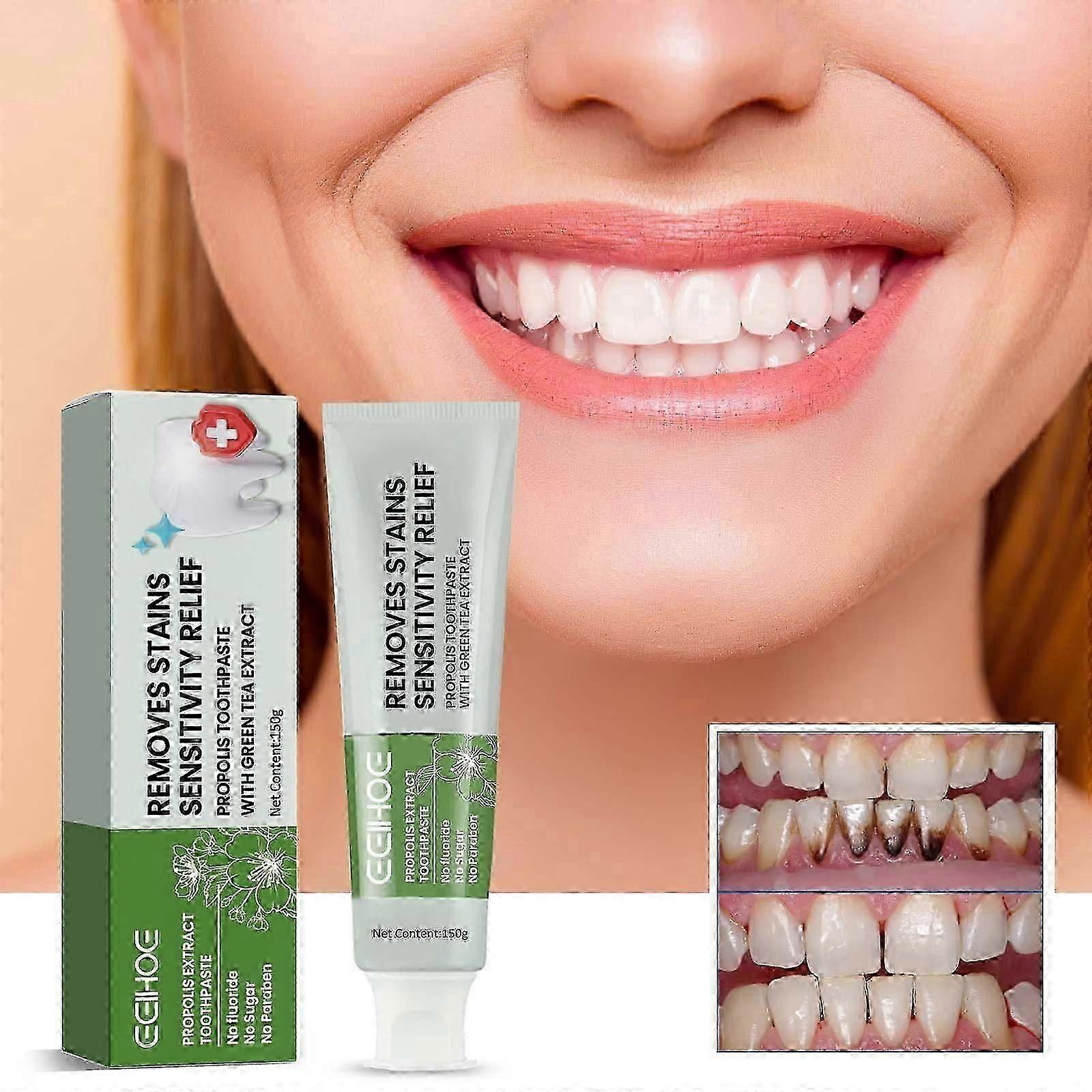 Propolis Toothpaste, Clean Stains Fresh Breath Tooth Whitening Toothpaste