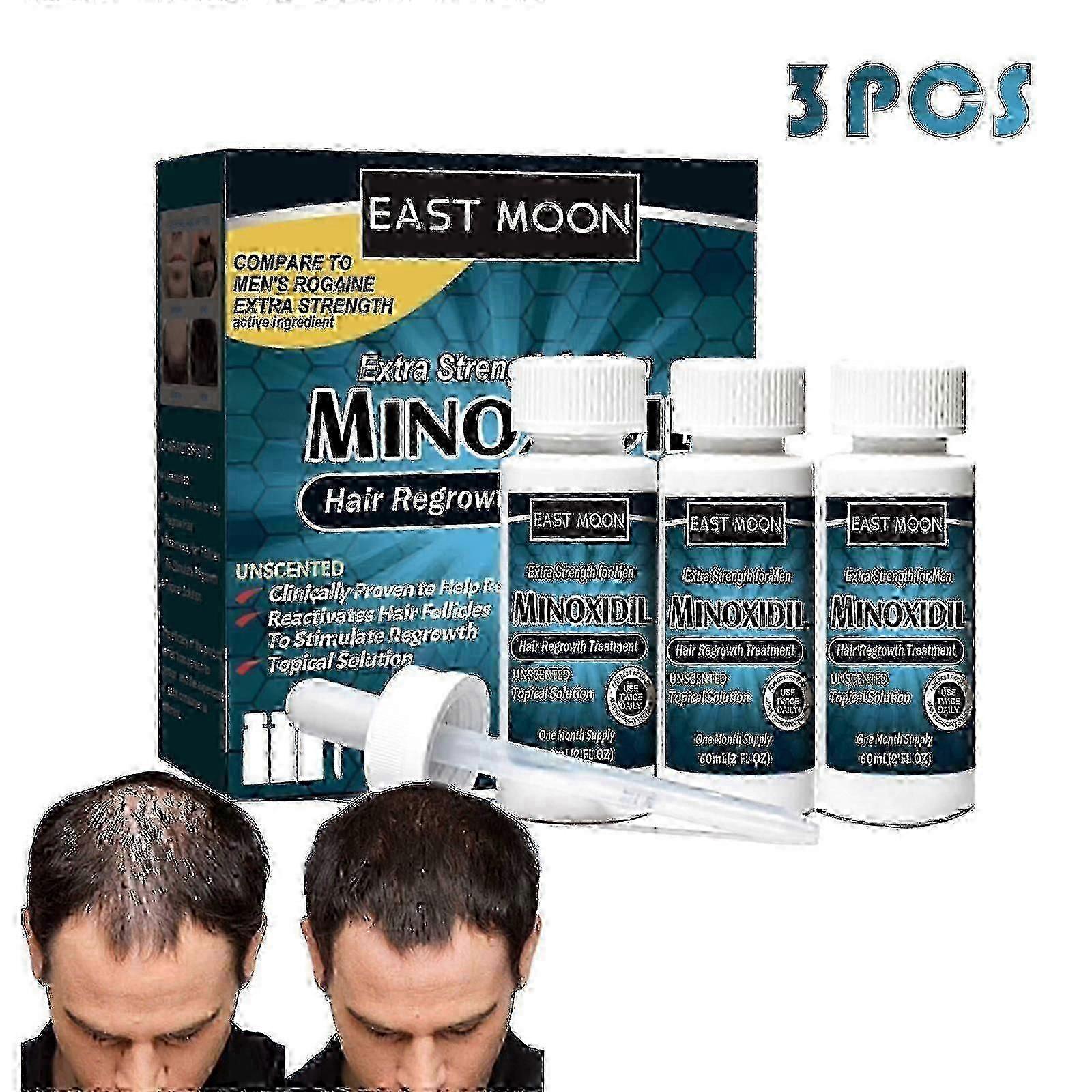 3 Extra Strength Men Hair Regrowth Solution Retail Box 25-26