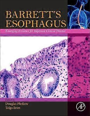 Barrett's Esophagus