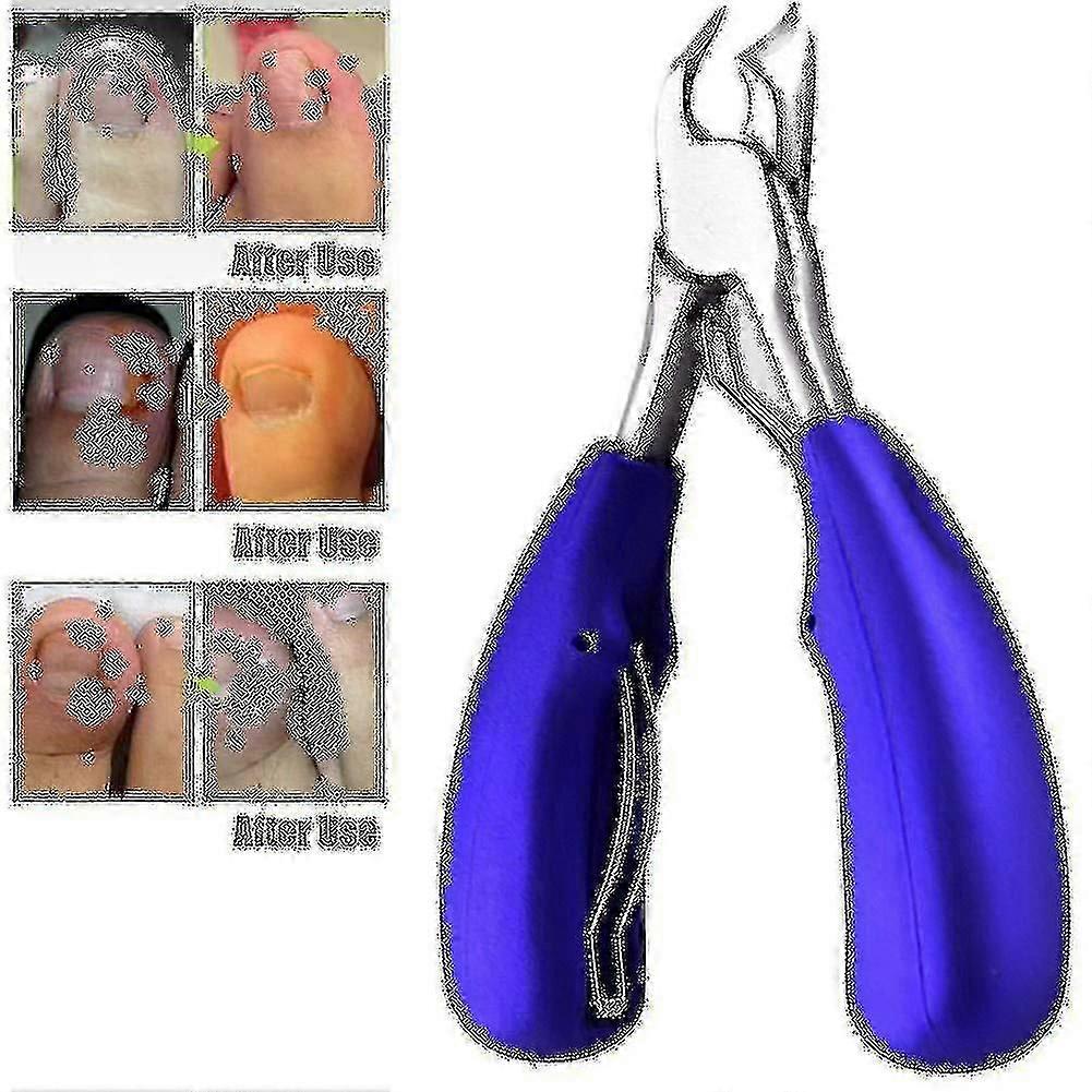Professional Toenail Clippers Compatible With Thick Or Ingrown Toenails - Precision Nail Clippers With Straight Lines