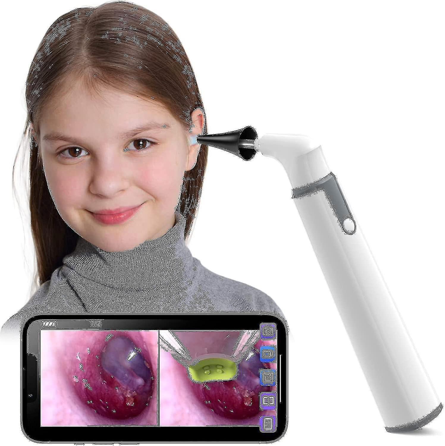 Wireless Otoscope Ear Camera With Dual View, 3.9mm 720phd Wifi Ear Scope With 6 Led Lights High Qual