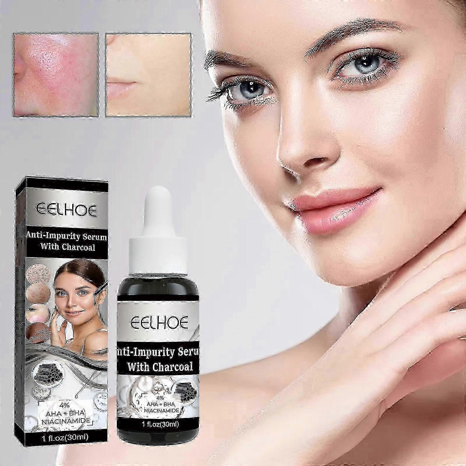 L’essence anti-impuretés au charbon EELHOE hydrate, hydrate, éclaircit, élimine les impuretés du visage, resserre et répare les