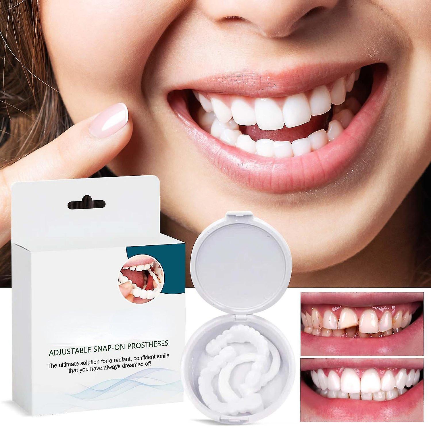 Adjustable Snap On Prothesens, Adjustable Snap On Denture, Silicone Whitening Denture Braces, Cover