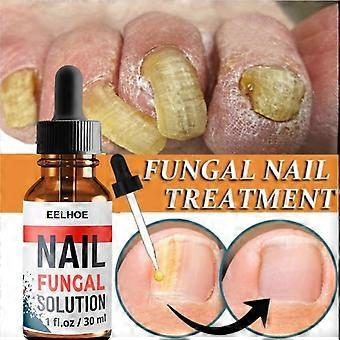 3PCS Nagel Reparatie Oplossing Hand & Voet Grijze Nagelverzorging Reparatie Grijze Nagel Oplossing