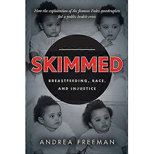 Leche Negra: Raza, Lactancia Materna e Injusticia