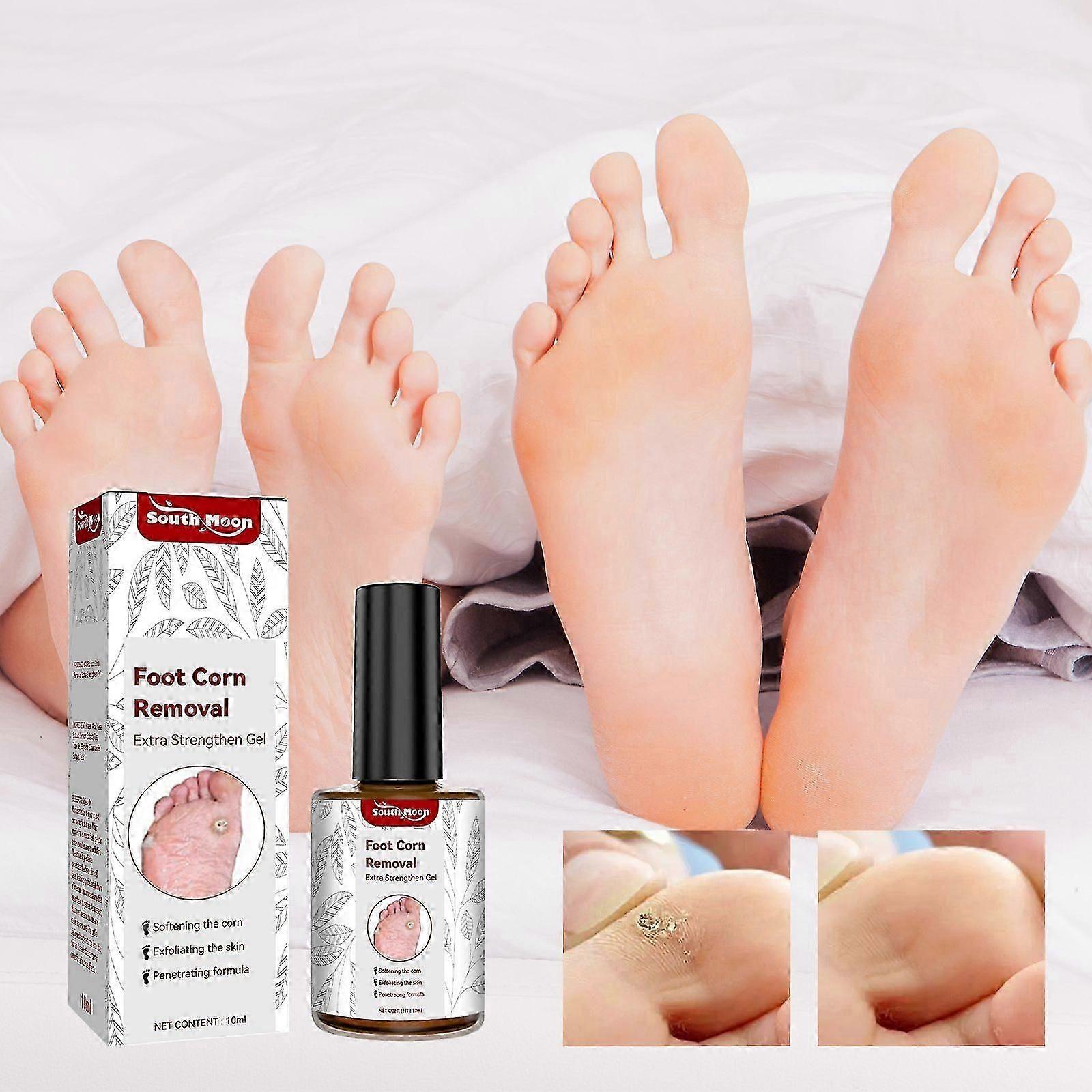 Extra Strength Foot Corn Removal Gel with Aloe Vera