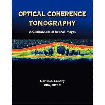 Tomografia a coerenza ottica un atlante clinico di immagini retiniche