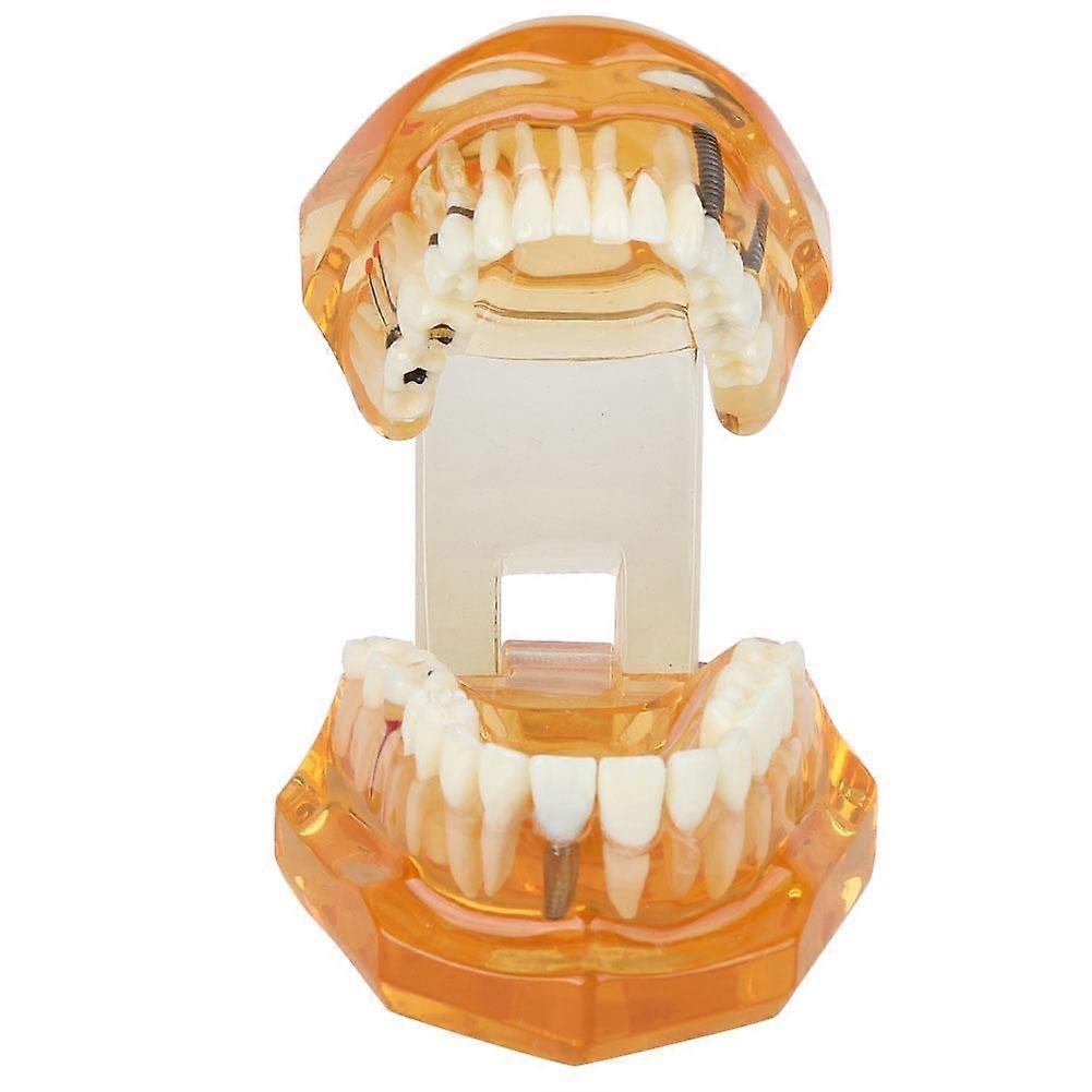 1pc Orange Color Dental Disease Removable Study Teaching Teeth Model