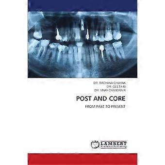 Post and core from past to present