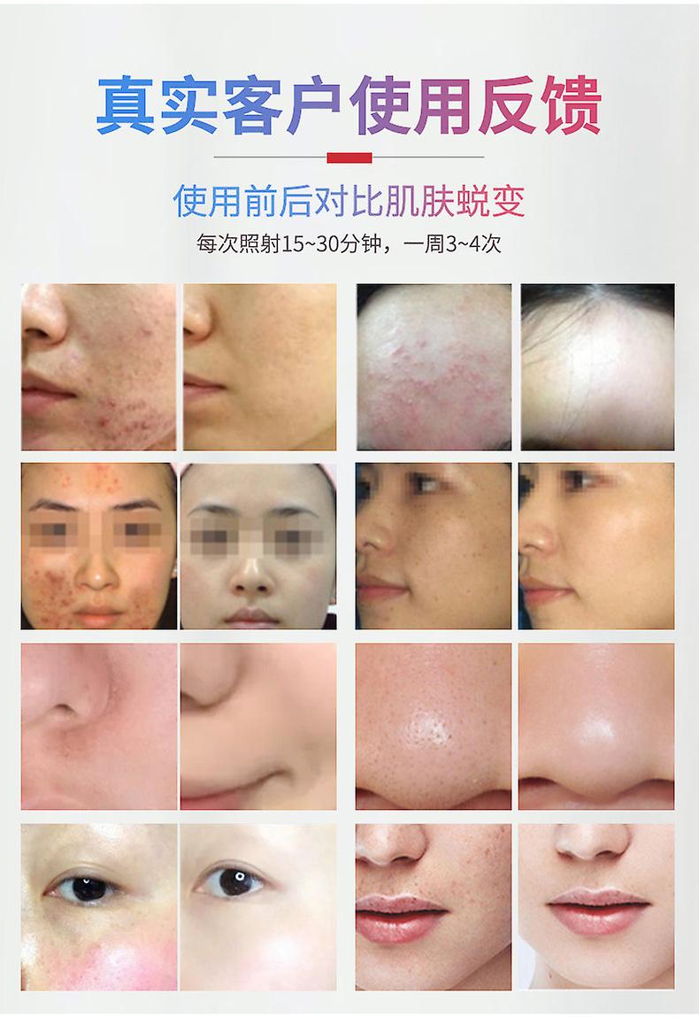 Hot Cold Seven-color Spectrum Led Light Photon Skin Rejuvenation Skin Whitening Spots Lightening Acne Removing