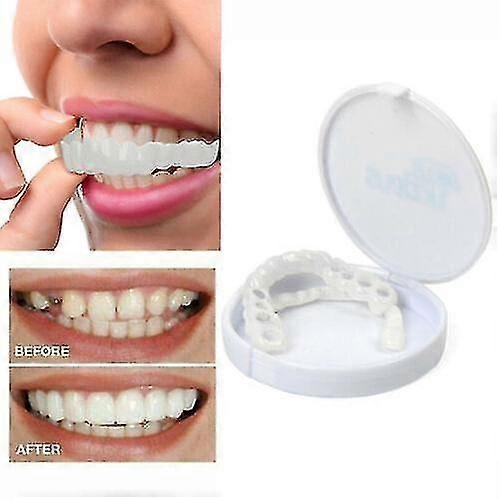 Hot Snapshot Upper Denture Upper + Lower Denture Veneer Denture Braces