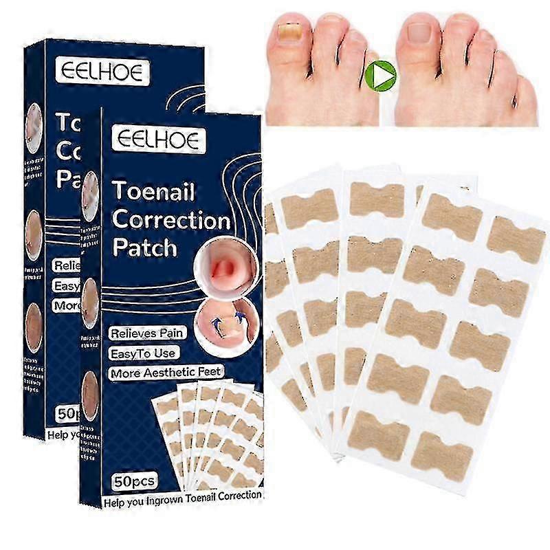 2パック真菌ネイルトリートメントパッチ、ネイルリペアパッチ真菌ネイルリペアトリートメント、爪真菌症の修復真菌ネイルパッチ