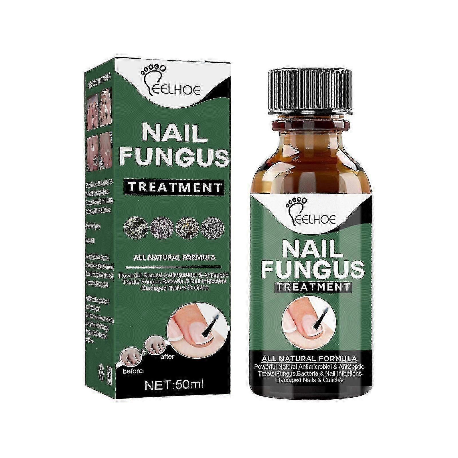 Traitement des champignons des ongles, traitement des champignons des ongles des orteils de 50 ml, solution de réparation des ongles extra forte avec extrait naturel d’huile d’arbre à thé