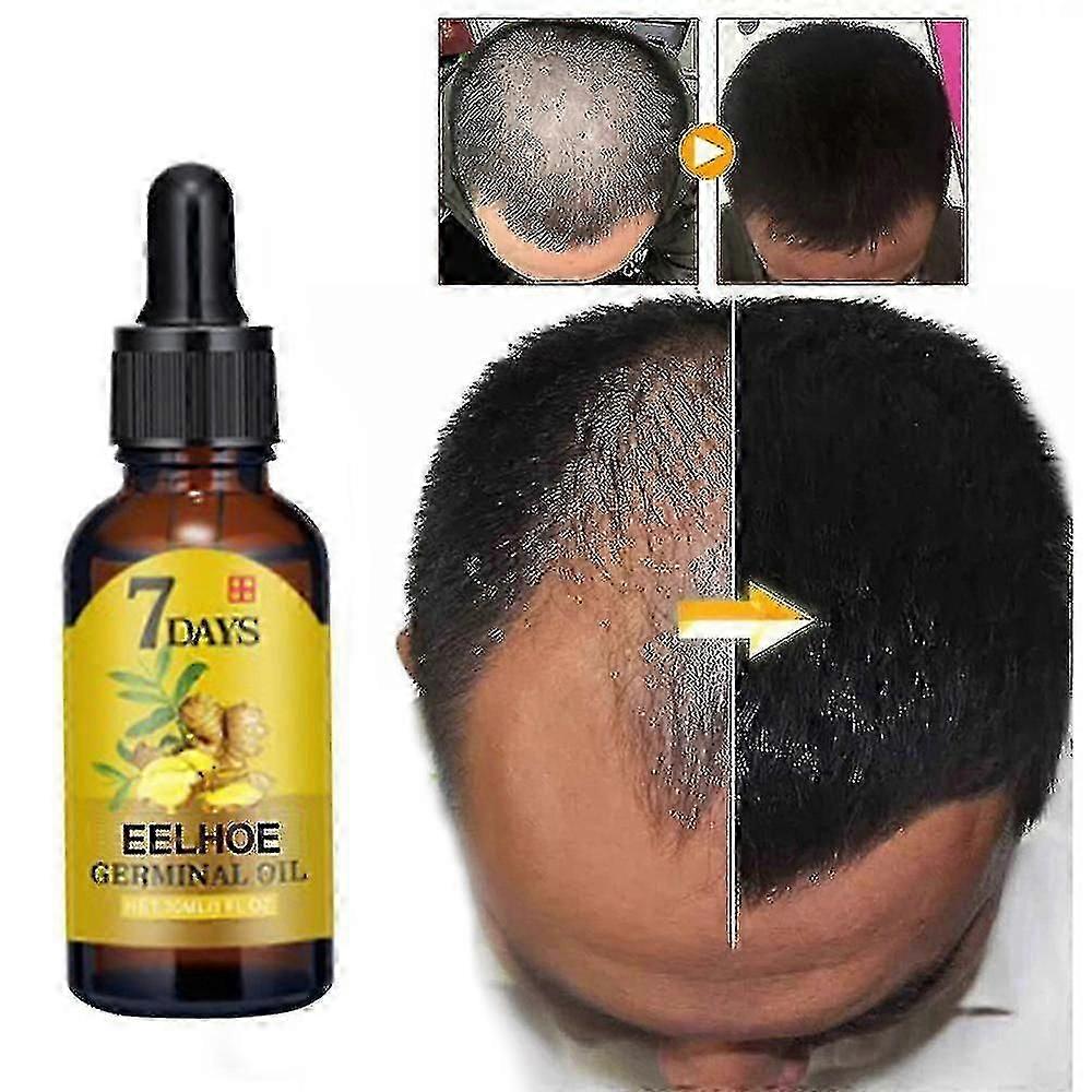 Eelhoe Ginger Haargroeivloeistof