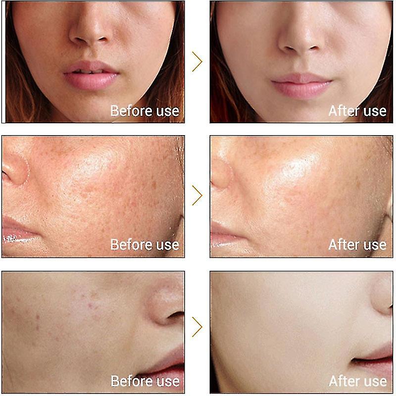 Vitamin C Whitening Face Serum Lighten Spots Brightening Facial Skin