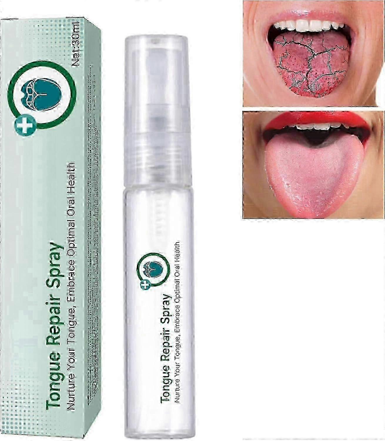 Spray reparator pentru limbă 1-3X 30ml, reduce umflarea limbii, tratament pentru respirație urât mirositoare, spray reparator pentru limbă uscată și respirație urât mirositoare