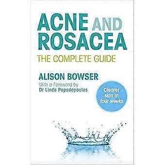 Acne and Rosacea The Complete Guide
