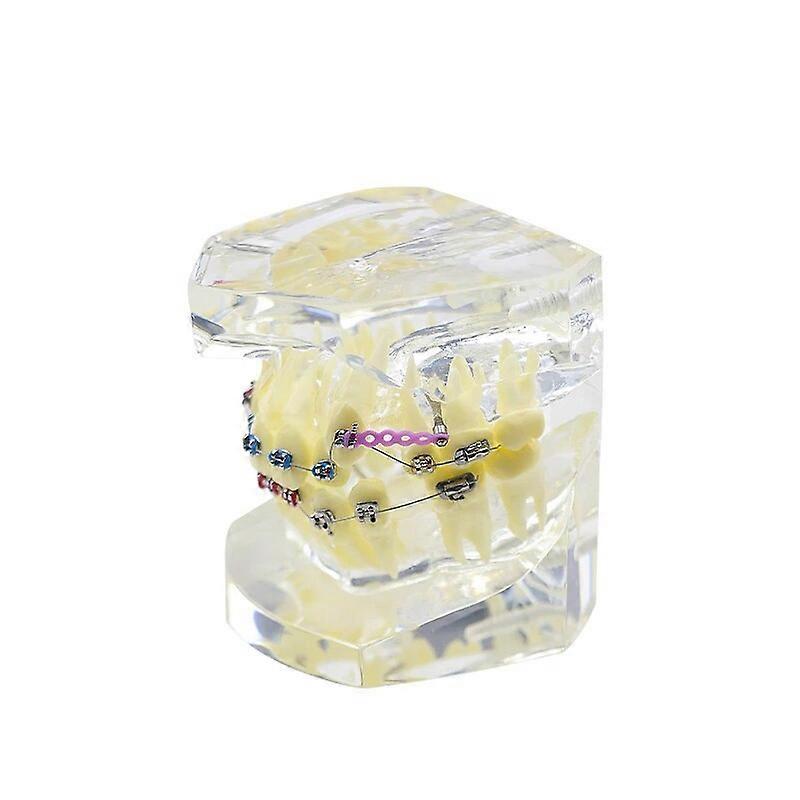 Model dinti ortodontici 1 bucata, model studiu malocluzie dentara, materiale dentare