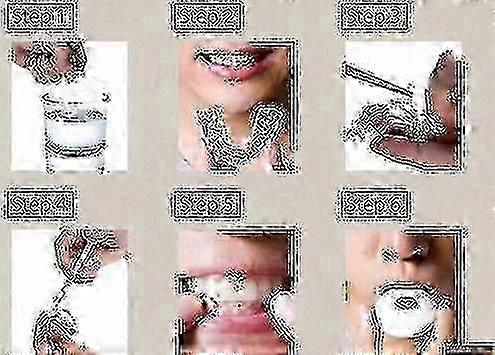 مجموعة من 4 لتبييض الأسنان / جل التبييض ، التشكيل الحراري وصول جديد