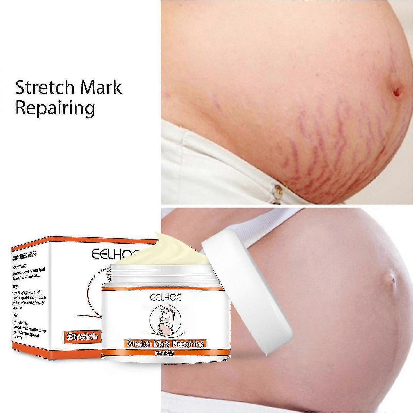 3x علامات التمدد إزالة كريم نمو الدهون خطوط الأمومة ندبات حب الشباب زيادة مرونة الجلد مكافحة التجاعيد شركة العناية بالجسم