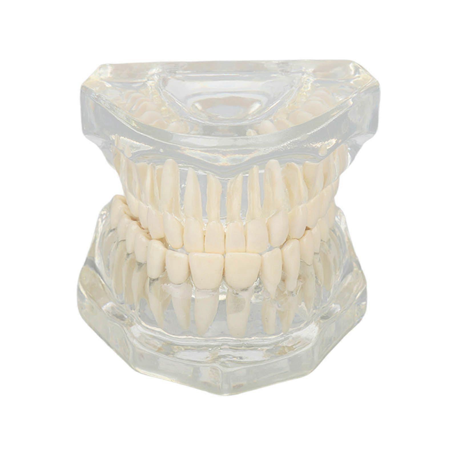 2025 Latest Model Transparent Dental Model Clear Structure Educational Dental ...