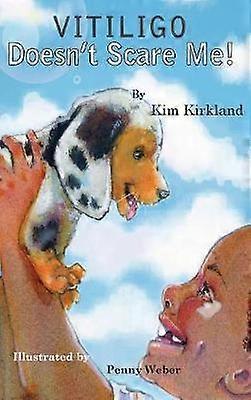 Vitiligo skrämmer mig inte