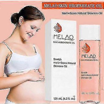 Natural Stretch Mark Oil 125ml – Anti-Aging and Acne Scar Treatment