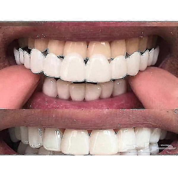 Upper/lower Comfort Fit Flex Whitening Denture Braces