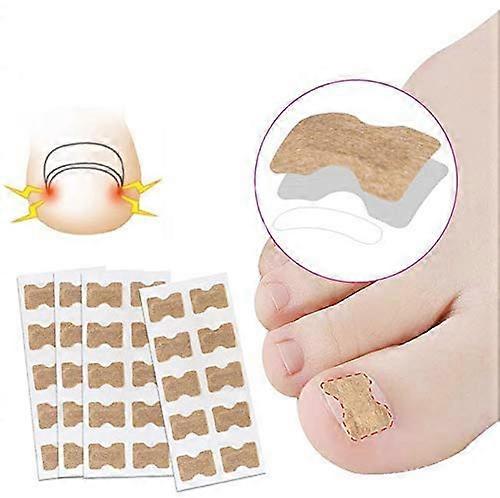 Ingrown Toenail Correction Patch 50PCS Glue Waterproof Breathable SelfAdhesive Strip