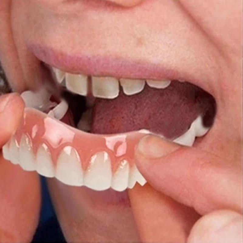 Comfortable Tooth Veneers - Soft Silicone Adhesive - Extra Thin White Shade - Orthodontic Teeth Hide