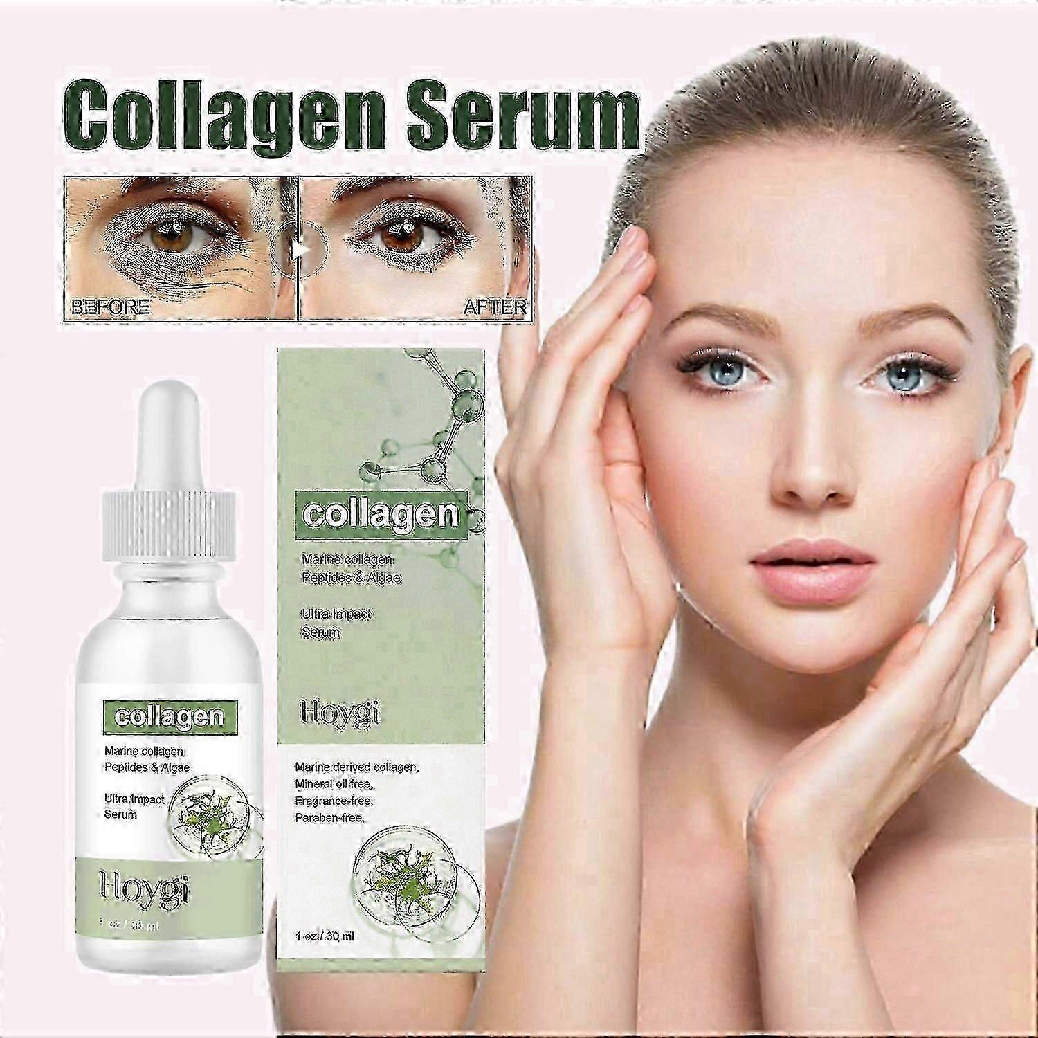Hoygi Collagen Serum, Lighten Lines Hydrating Firming And Anti-wrinkle Serum