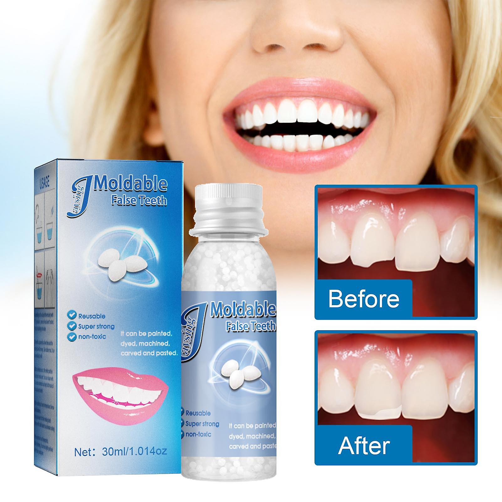 Tooth Repair Granules Broken Teeth Filled Space Temporary Quick & Safe for Temporary Fixing Tooth