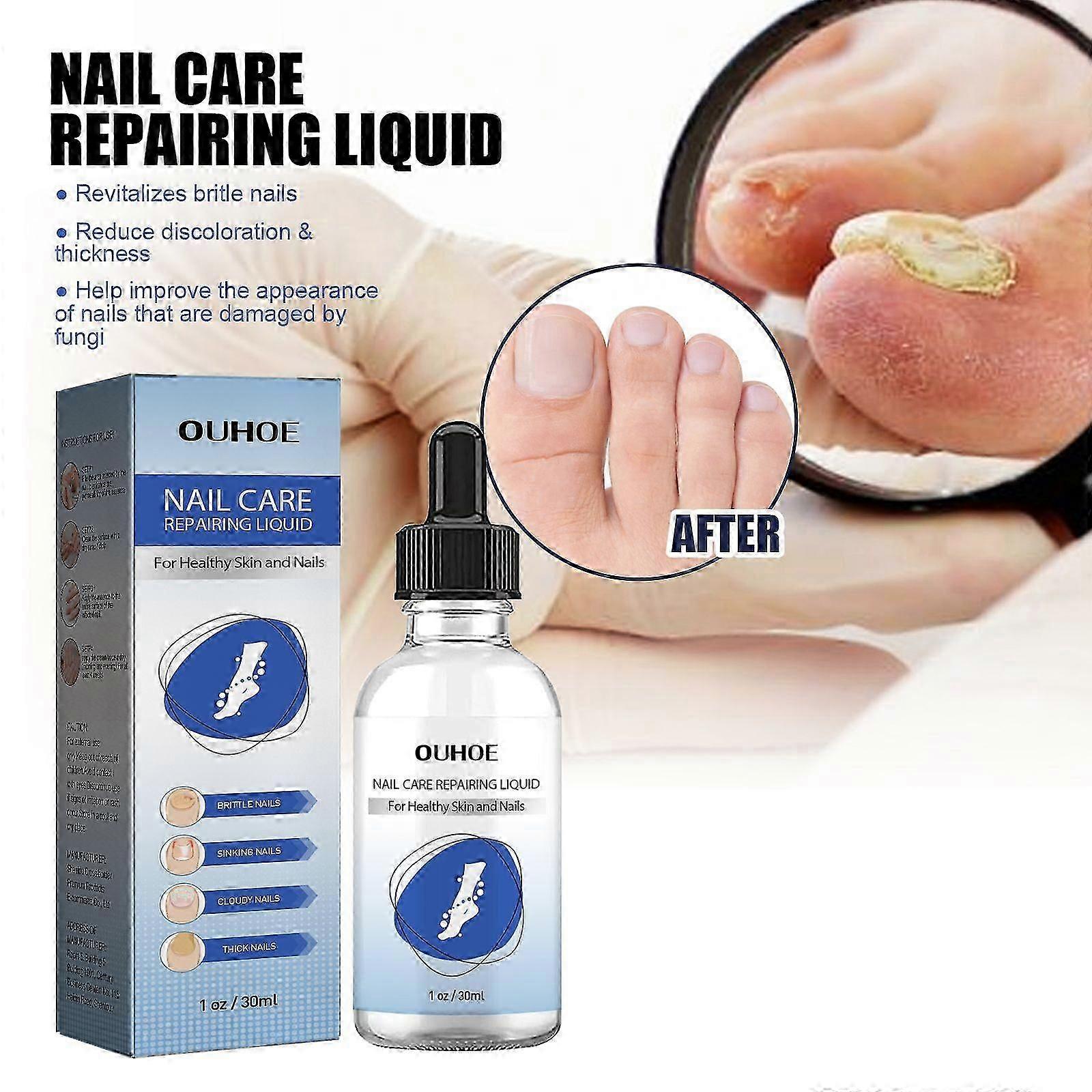 Nail Repair Essence