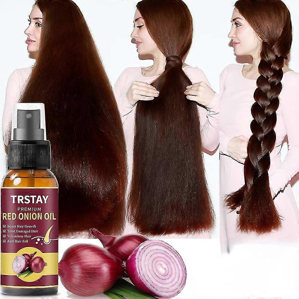 Hair Grouth Fast Onion Black Seed Essential Oils Oil Spray For Hair Care And Growth To Prevent Hair Loss