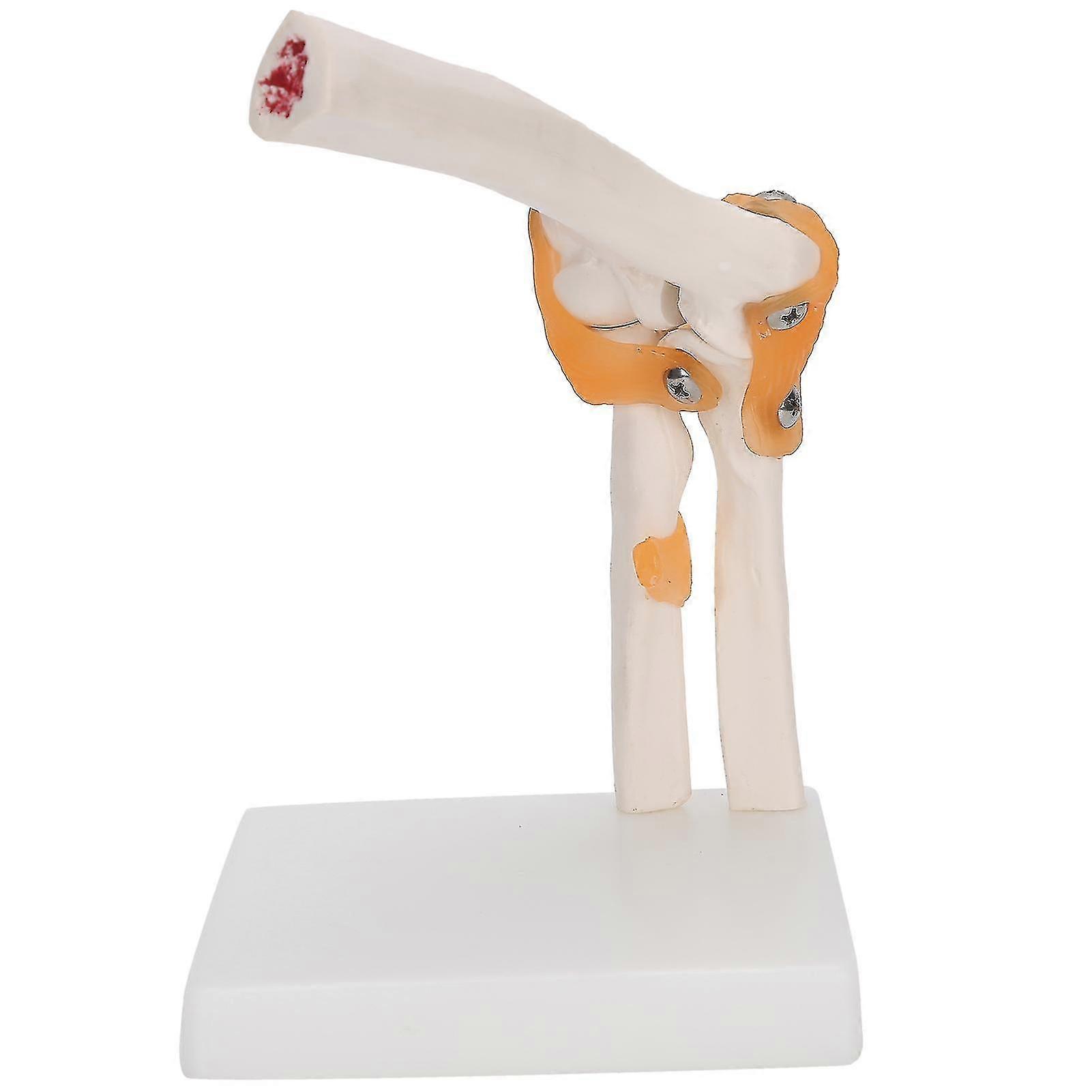 2024 New,elbow Joint Model Life Size Accurate Elbow Skeleton Model For Study Display Teaching