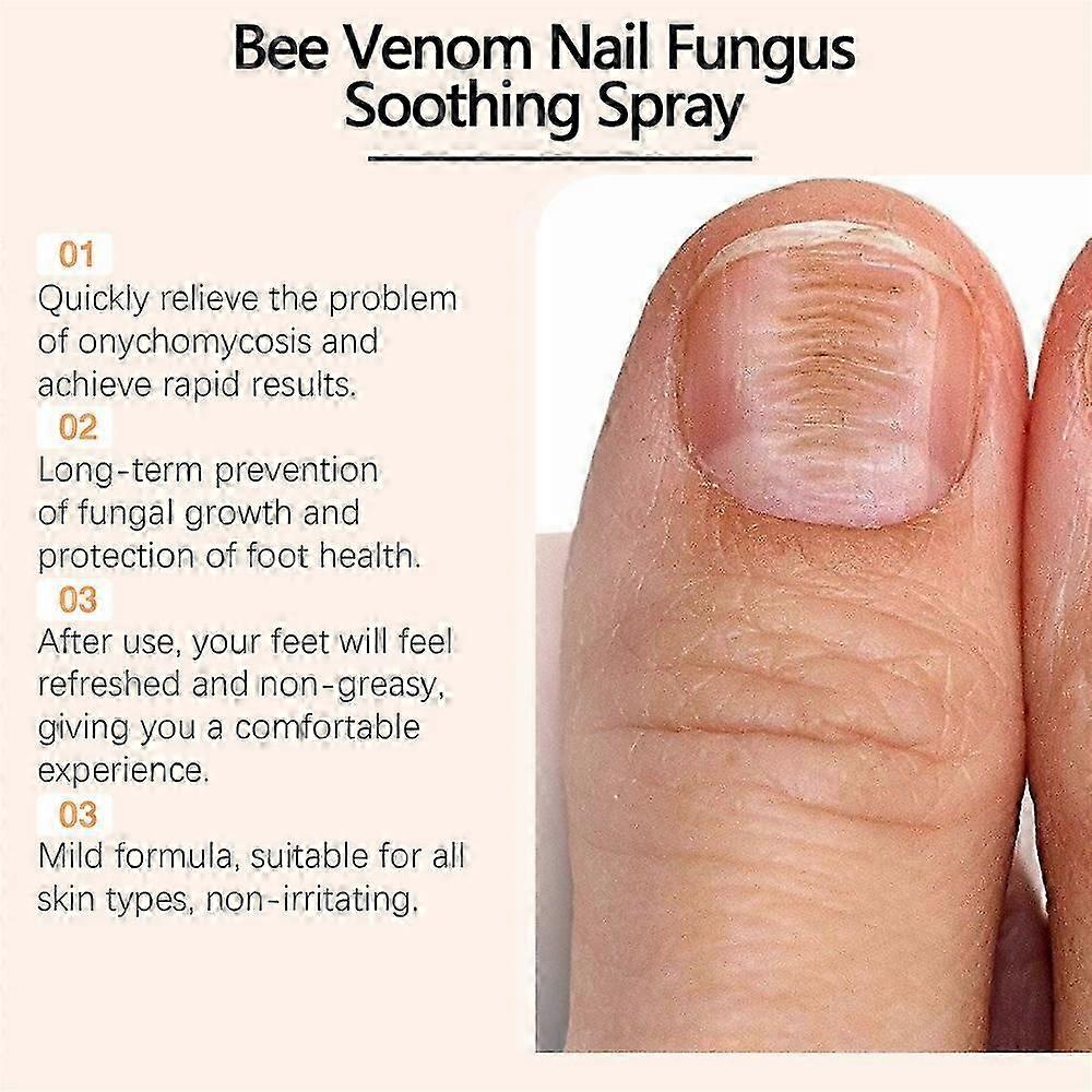 Solução natural para cuidados com as unhas com veneno de abelha