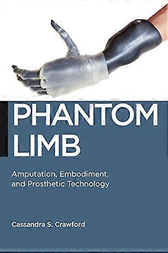 Phantom Limb: Amputation Embodiment and Prosthetic Technology