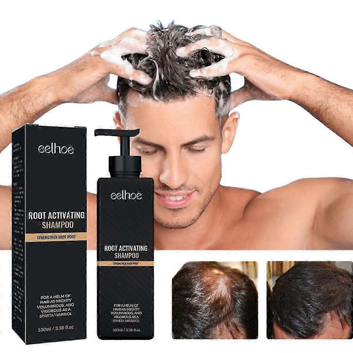 Root Activator Shampoo - 3er Packung zur Behandlung und zum Wachstum von Haarausfall