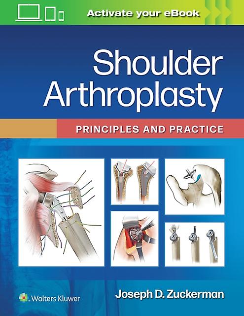 Shoulder Arthroplasty by Zuckerman & Joseph D. & MD Paperback Book