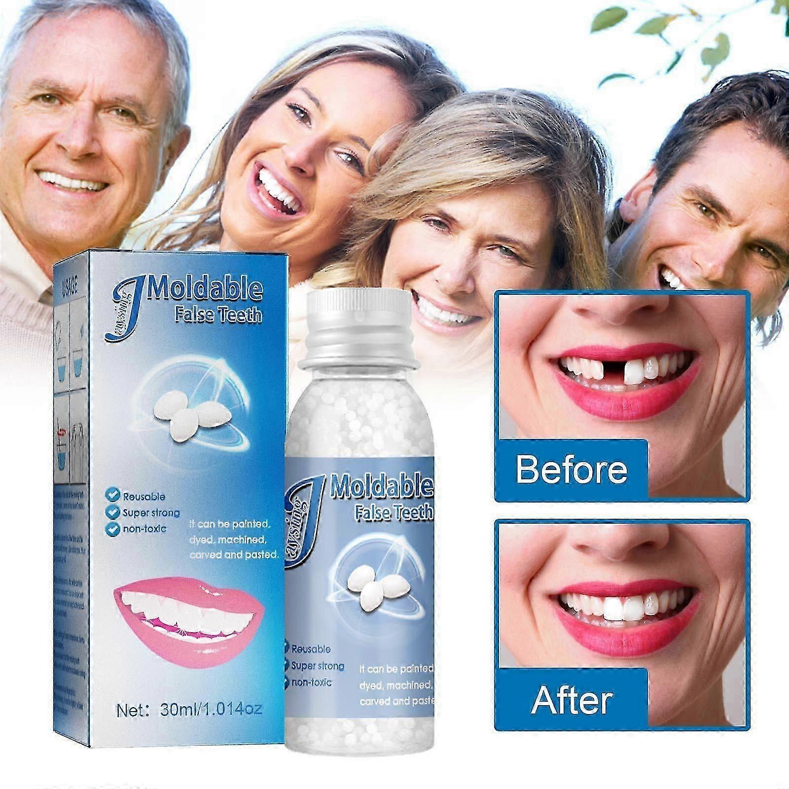 2 db-os fogjavító granulátum ideiglenes fogjavító készlet hőgyöngyök fogjavító készlet újrafelhasználható