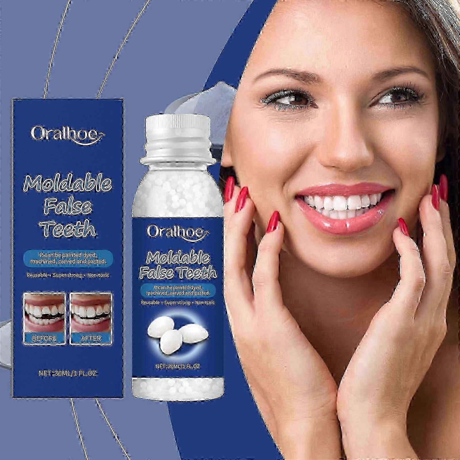 suitable for temporary teeth replacement, 30ml moldable thermal fitting beads kit for restoration of missing broken teeth