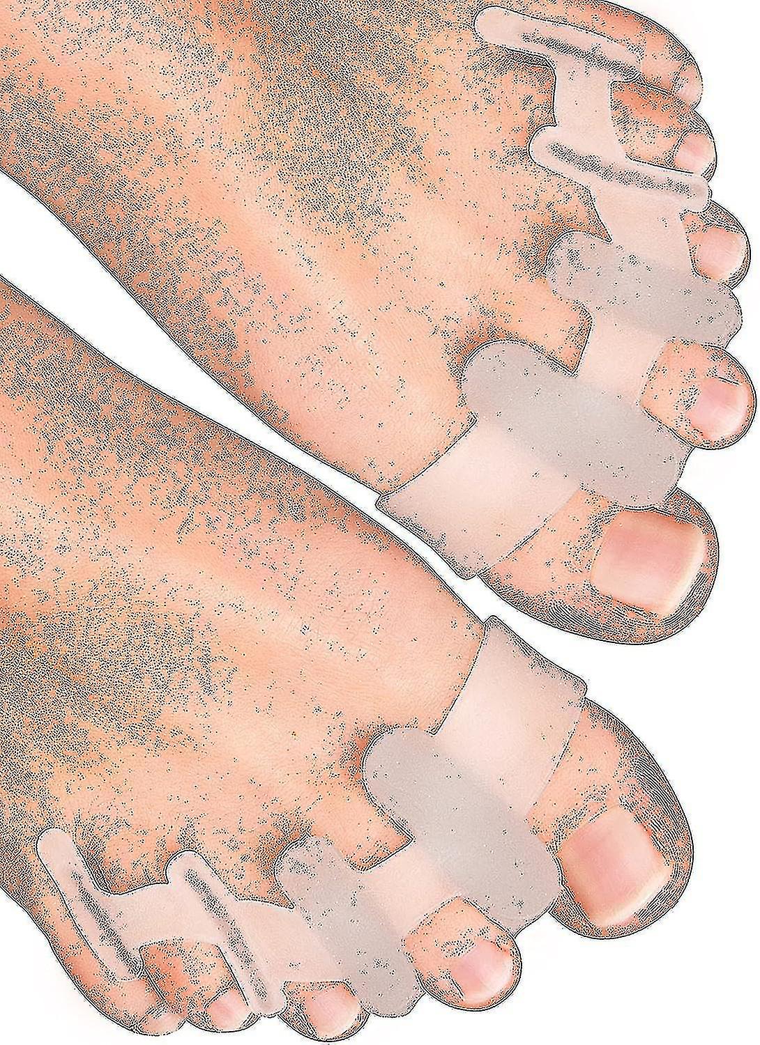 Yogamedic Toe Separator For Overlapping Toes 6pcs Improved Silicone, 0% Bpa, Onesize  Bunion Corrector Toe Straightener To Relax, Spread And Stretch -