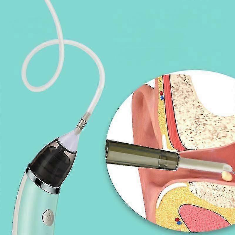 Electric Ear Wax Removal Tool with USB Charging, 5 Suction Levels for Safe and Reusable Ear Cleaning at Home