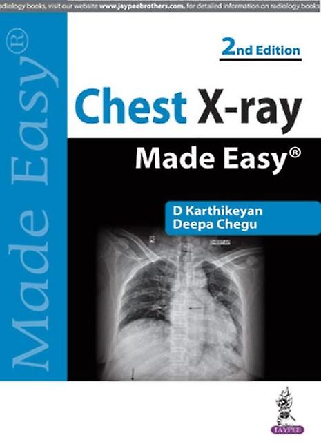 Chest Xray Made Easy by Deepa Chegu Paperback Book