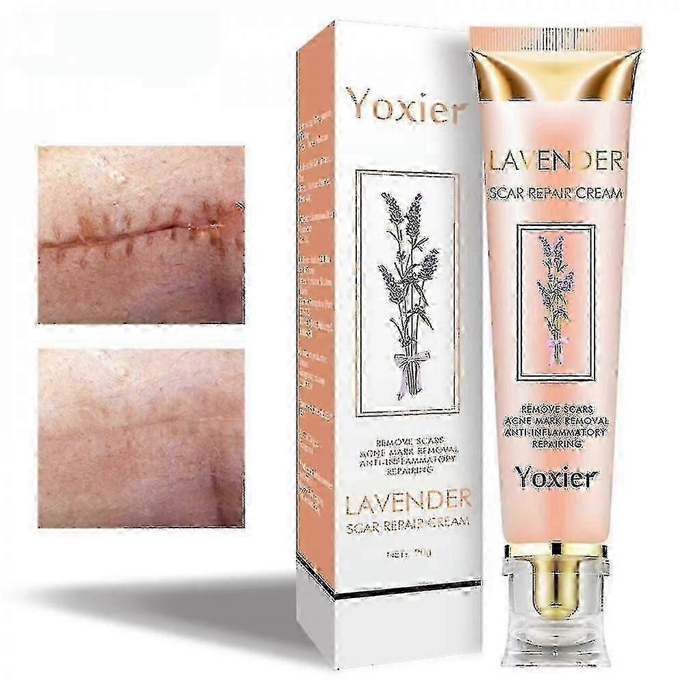 20gラベンダーの傷跡の修理クリーム女性男性のための効果的なにきびの傷跡除去ジェル