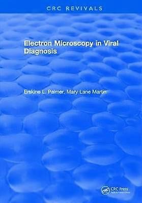 Electron Microscopy in Viral Diagnosis