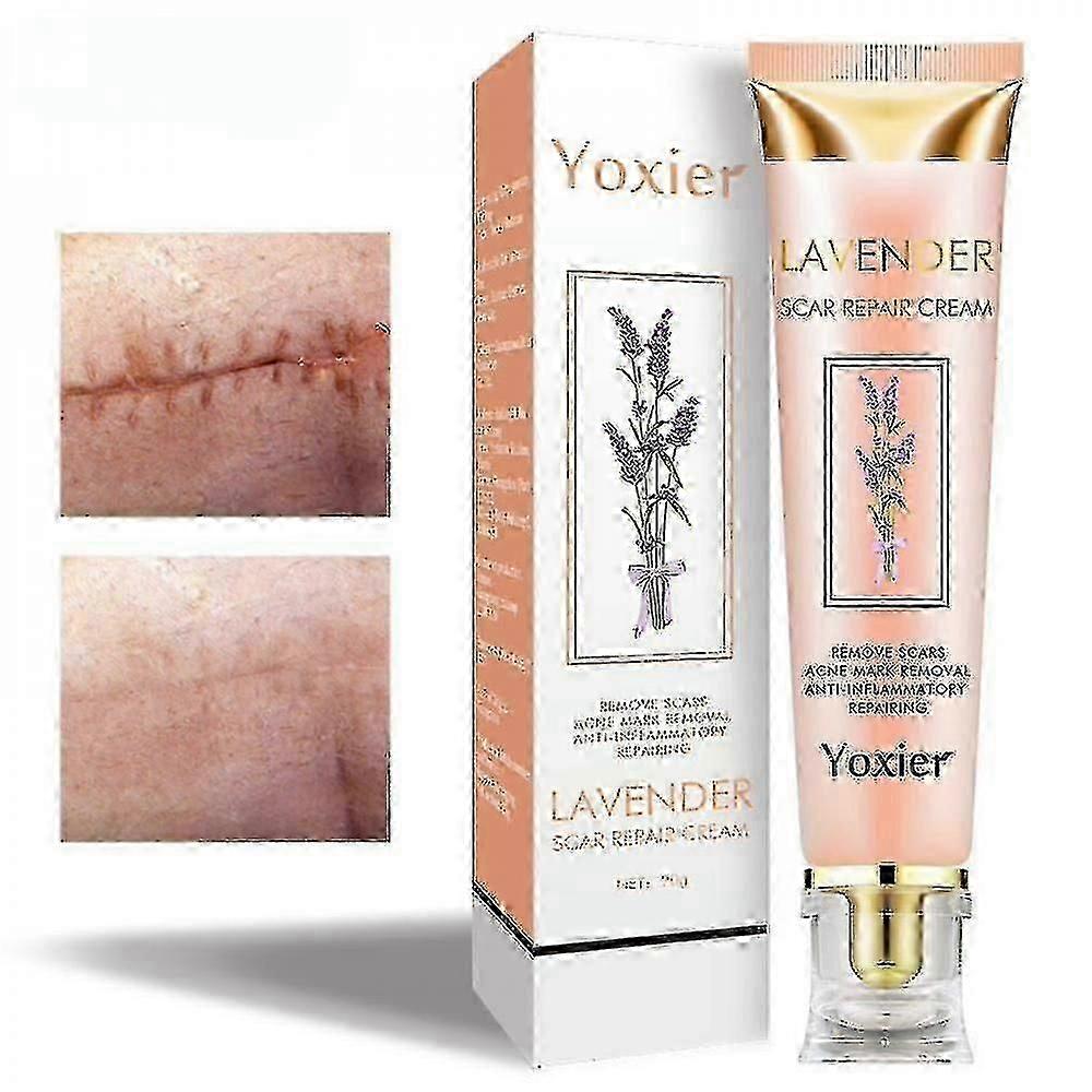 20 جرام كريم إصلاح ندبات اللافندر جل إزالة ندبات حب الشباب الفعال للنساء والرجال