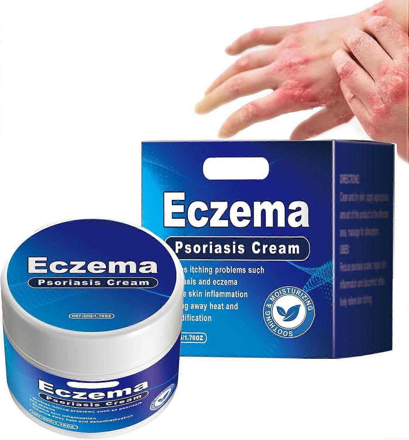 1/2/3pcs 乾癬コントロールクリーム、乾癬治療クリーム、赤みと不快感のためのかゆみ止め鎮静クリーム、フェイス&ボディレリーフクリーム