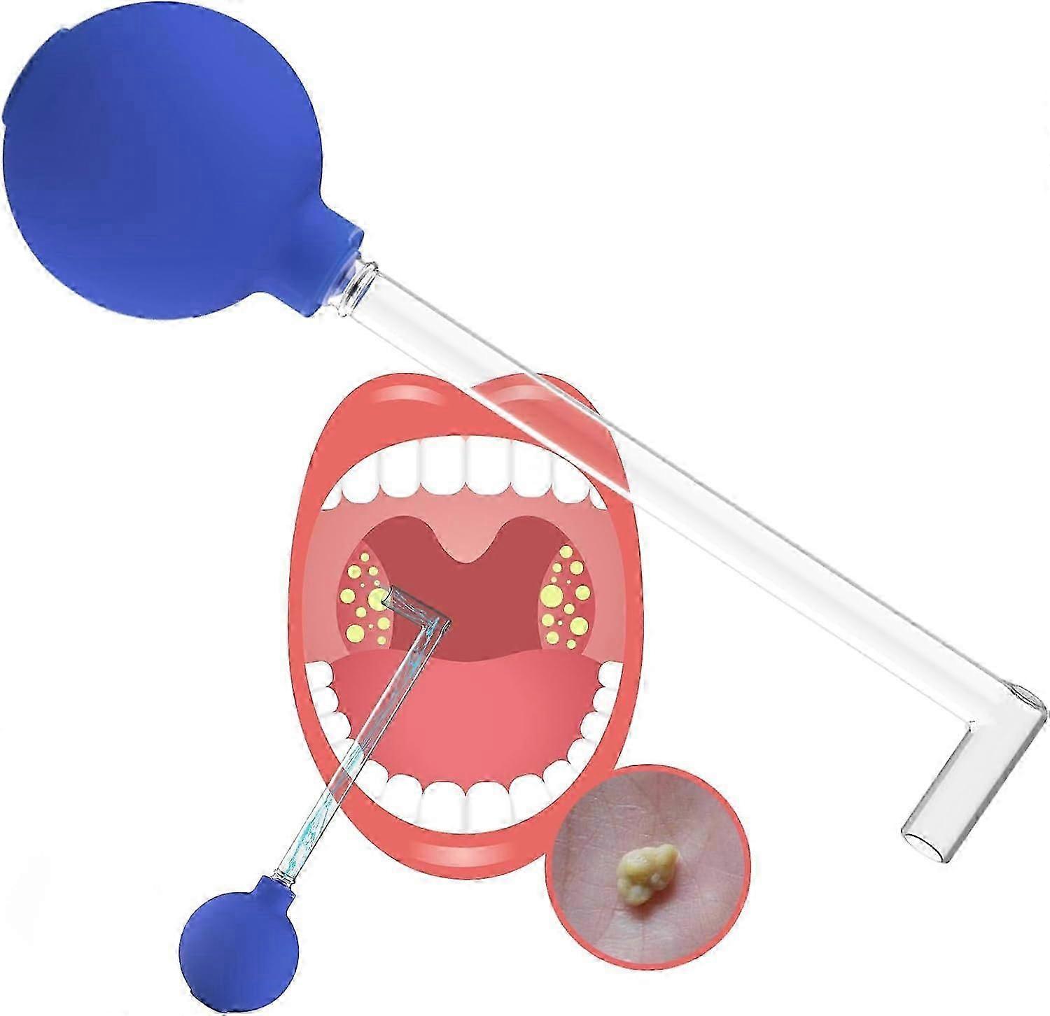 Tonsil Stone Remover Vacuum, Tonsil Stone Remover Kit