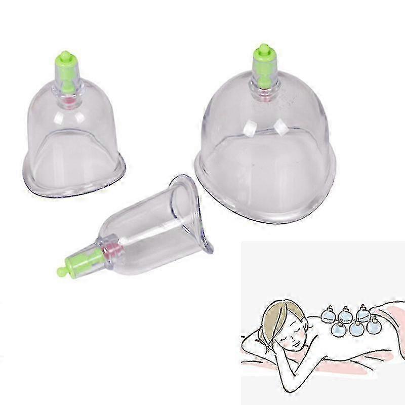 Traditional Chinese Cupping Kit C1 3 Cups for Back Pain and Detox